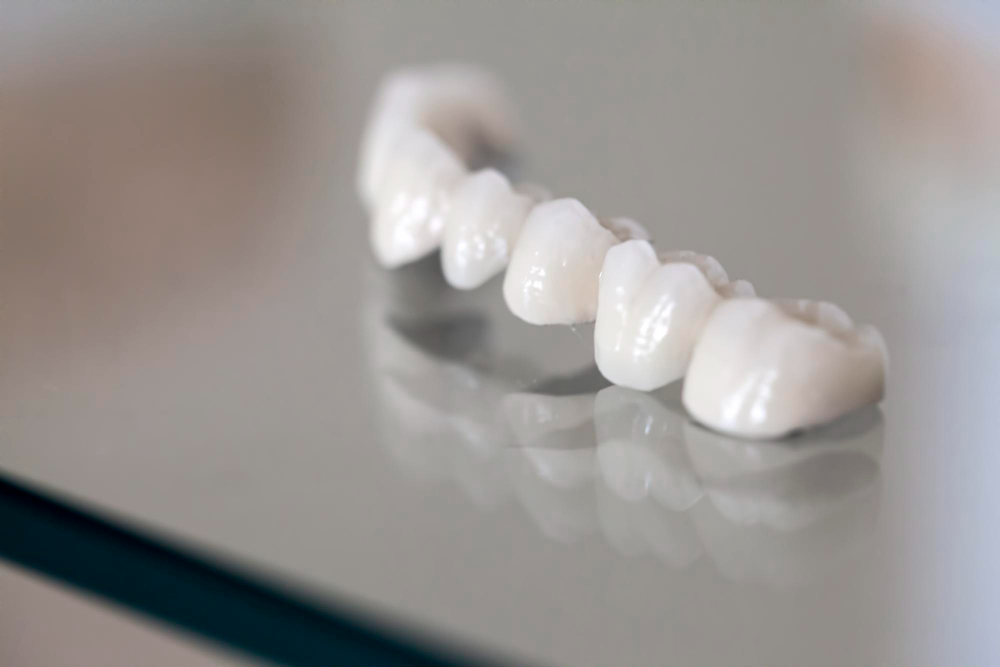 Porcelain Crowns  Houston, TX