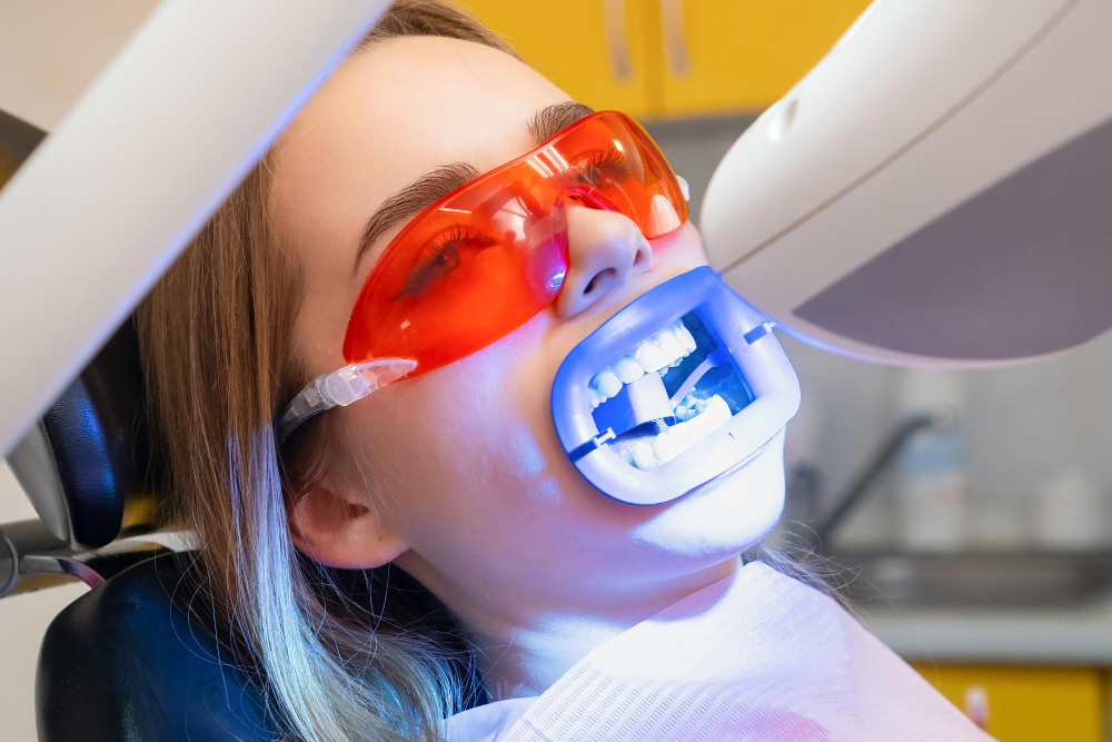 Teeth Whitening  Houston, TX